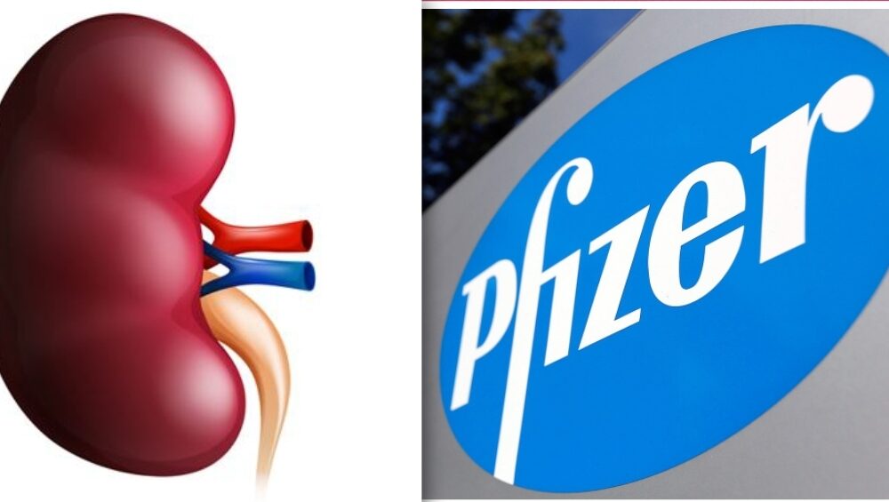 kidney
