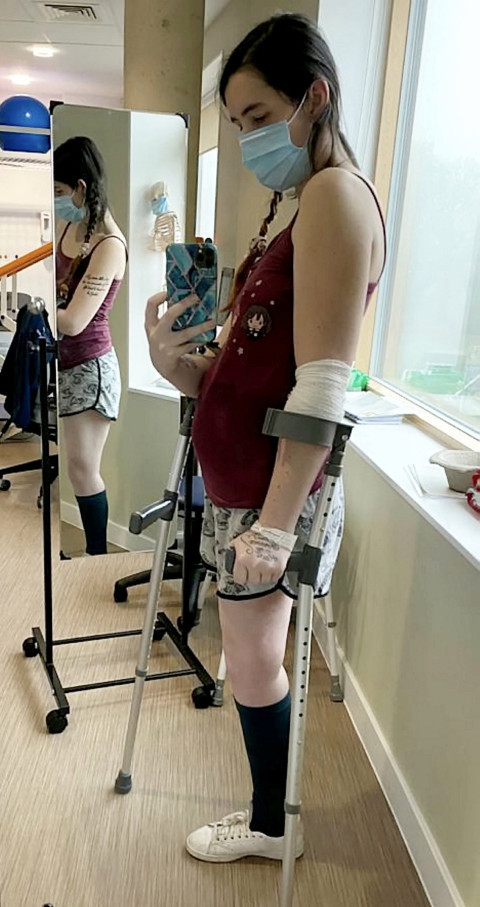 pregnant woman cut off leg