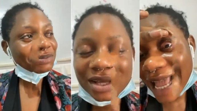 lady with contact lens
