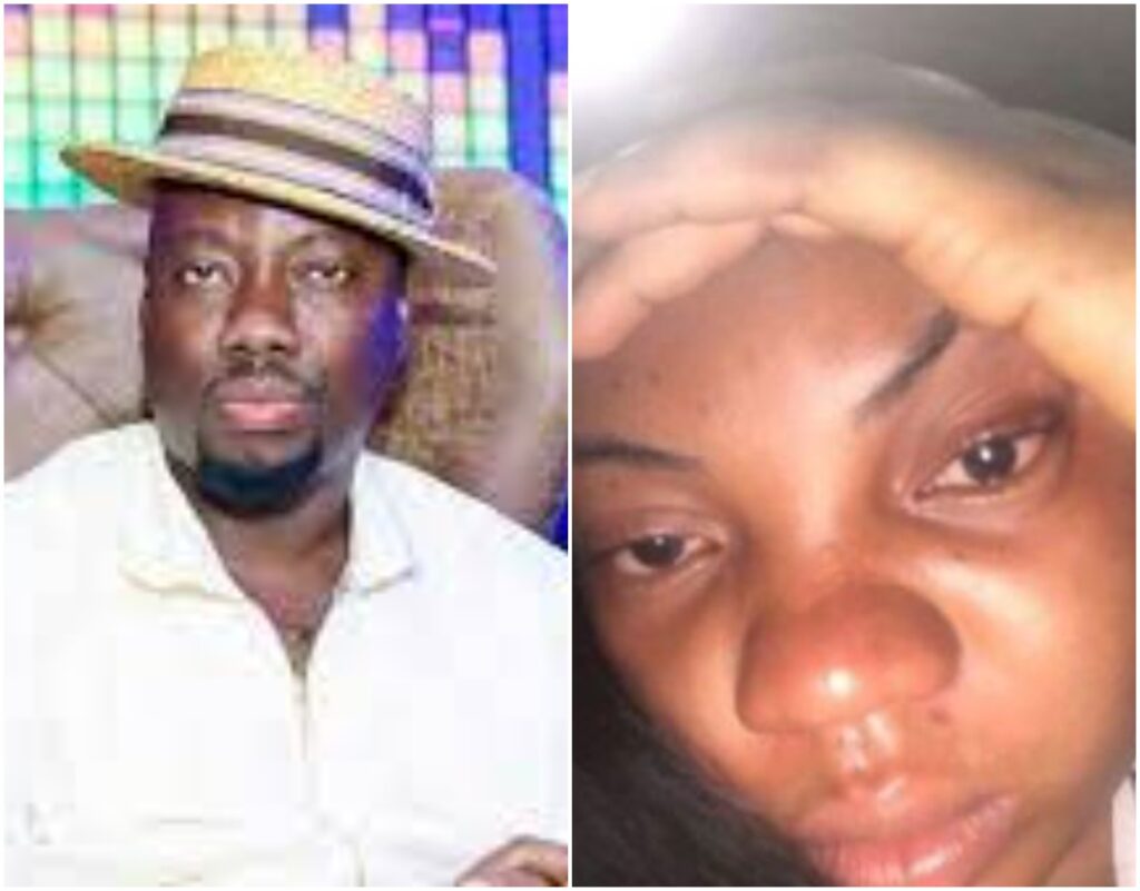 PHOTOS Lady In Severe Pains Calls Out Obi Cubana After Receiving Beating Of Her Life In His Club