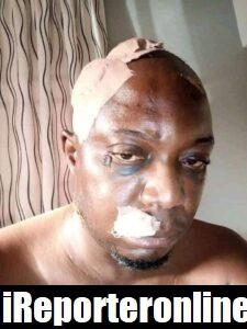 See The Face Of The Man That Was Beaten To Stupor By The Wife Who Is A Former Reps Member(Photos) 67 266021055 4842912389100178 8496373345521275717 n