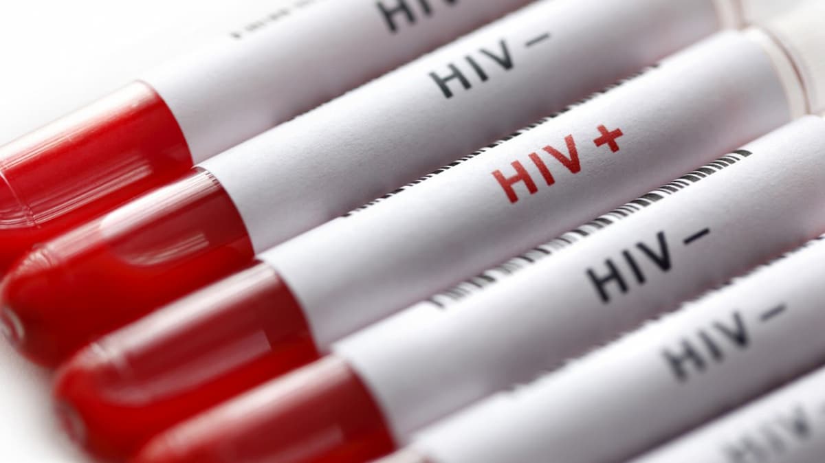 HIV