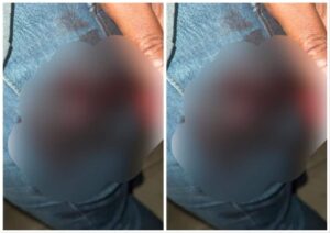 Man Escapes With Bullet Wound After Being Attacked By Suspected Kidnappers In Abuja 1536x1086 1