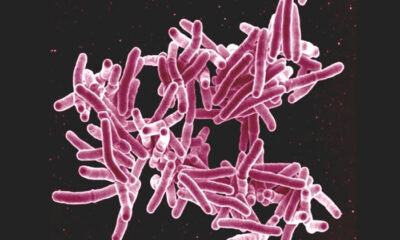 Tuberculosis Bacteria