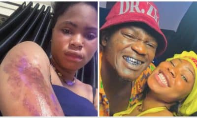 Portables Wife Speaks On Suffering Domestic Violence As Photos Of Assault Flood Online 400x240 2