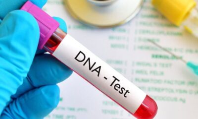 DNA tests1 1024x576 1